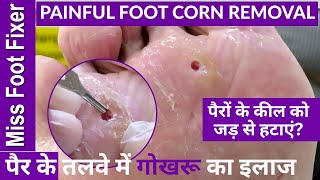 पैर में Foot Corn यानी गोखरू होना आम बात है, इससे कैसे बचें? | Foot Corn | Born Creator #corn