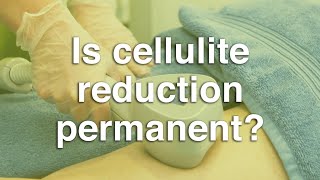 Is cellulite reduction permanent? | The Body Clinic | Cellulite FAQ 🍊