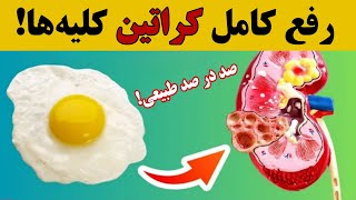 با این مواد غذایی کراتین کلیه‌هایتان را کاهش دهید | کاهش کراتین خون