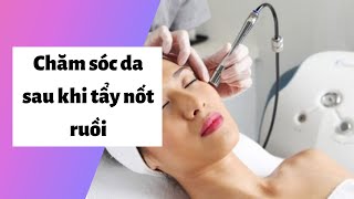 Chăm sóc da sau khi tẩy nốt ruồi: 5 Điều cần phải ghi nhớ