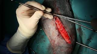 Femoral fracture plating in a dog