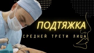 ПОДТЯЖКА ЛИЦА I До/После в конце видео