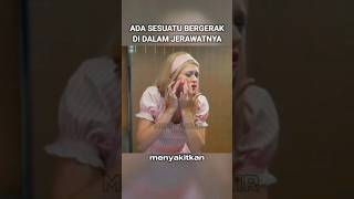 Ada Yang Bergerak Di Dalam Jerawat Gadis Ini