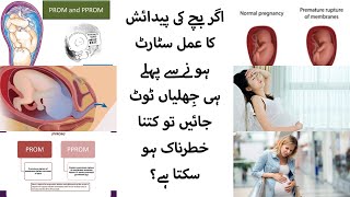 PROM & PPROM Urdu video