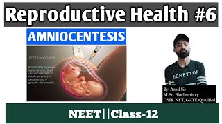 Amniocentesis ( उल्बवेधन )|Reproductive Health#6 |Ch-4|Biology Class-12|NEET|NCERT