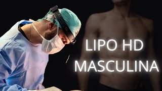 Quais os processos da Lipo HD masculina?