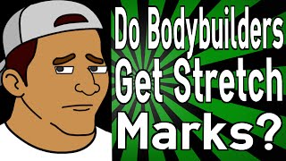 Do Bodybuilders Get Stretch Marks?