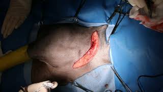 Axillary lipoma in a dog