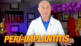 Peri-Implantitis