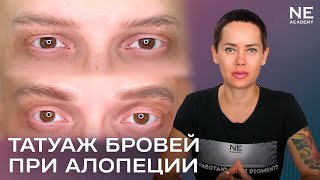 Алексей. #Татуаж бровей при алопеции