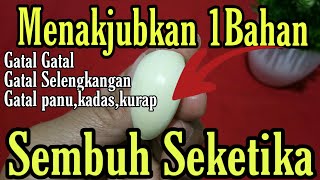 Menakjubkan 1Bahan Alami Mengobati Gatal Gatal, Gatal Selengkangan,Gatal kulit