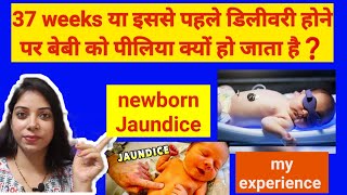 37 weeks या इससे पहले डिलीवरी होने पर बेबी को पीलिया क्यों हो जाता है | Newborn jaundice |