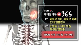 [메디컬다큐365] 새로운 치아, 새로운 세계 전체 임플란트 / 노화된 인대의 역습 척추관협착증 (23.10.30 예고편)