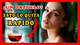 Como quitar un orzuelo del ojo rapido con remedios caseros naturales:Remedios para orzuelos