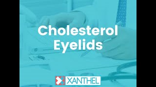 Cholesterol Eyelids - Help & Advice Guide About Cholesterol Eyelids - Brought To You By XANTHEL®