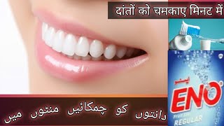 teeth whitening remedy at home(work 💯)all teeth problem solve|| دانتوں کو چمکائیں منٹوں میں