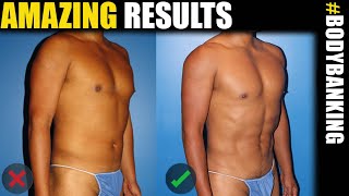 Male Plastic Surgery Expert Reveals Latest BodyBanking Results