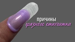 ПРИЧИНЫ ГРЯЗНОГО ОТПЕЧАТКА при работе с верхними формами