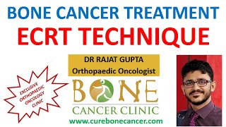 Bone Cancer Treatment Limb Salvage Surgery for Osteosarcoma (Bone Cancer) with ECRT technique