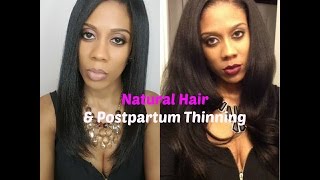 Natural Hair and Postpartum Thinning