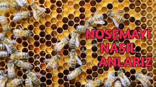 arılarda nosema ve varroa tehlikesi detaylı anlatım ne Fayda