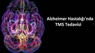 Alzheimer TMS Tedavisi Nedir?