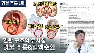 귓불 주름 1편: 귓불주름을 통해 예측해보는 뇌혈관, 심혈관질환의 관련성에 대한 신경외과 의사의 관점에서 해석