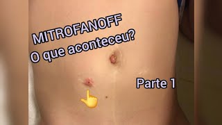 CIRURGIA MITROFANOFF, Parte 1 - O que aconteceu? @SilvinhoSobreRodas