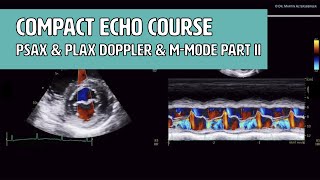 〖Echocardiography〗 PSAX & PLAX Doppler & M-Mode measurements II