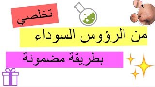 الطريقة الفعالة لازالة الرؤوس السوداء في البيت| مع رانيا عبدالله ❣