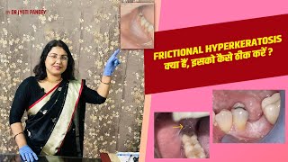 Frictional Hyperkeratosis क्या हैं ,इसको कैसे ठीक करें