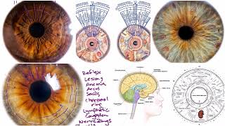 Assessing Brain Health & Vitality Through the Science of Iridology; Brain Anatomy & Iris Brain Zones