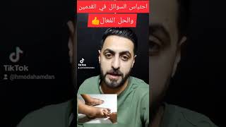 احتباس السوائل بالقدمين والحل البسيط بإذن  الله 👍🔥