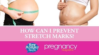 How Can I Prevent Stretchmarks?