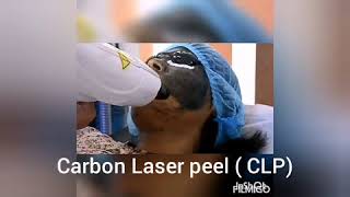 Carbon Laser peel