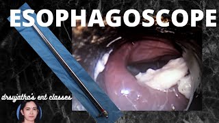 104.Rigid esophagoscopy -   Indication Contraindication Procedure steps.  #oesophagus #scopy