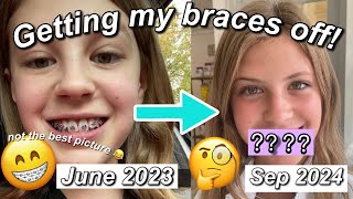 GETTING MY BRACES OFF!