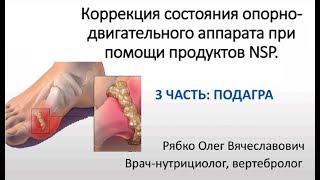 3 часть: Подагра. Коррекция состояния при подагре с помощью БАД NSP