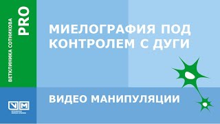 Миелография под контролем С дуги