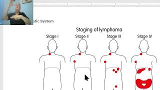 Lymphatic disorders in Arabic 2 (Lymphomas , part 2 ) , by Dr. Wahdan