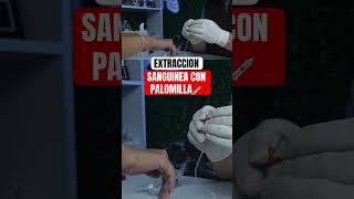 EXTRACCION SANGUINEA con PALOMILLA #enfermeria #inyeccion #nurse