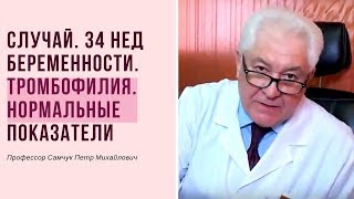 Случай тромбофилии при беременности.