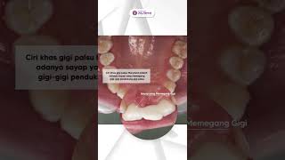 Gigi ompong memang sangat meresahkan ya :( #shortvideo #asmr #fypシ #shortvideo #viral #health #meme