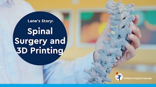 Spinal Surgery and 3D Printing