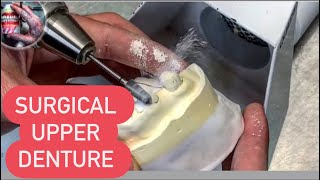 PART 1 HOW DENTURES ARE MADE (IMMEDIATE/SURGICAL UPPER DENTURE)