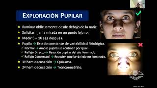 Defecto Pupilar Eferente