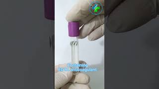 CBC tube | EDTA Anticoagulants | EDTA Vial | CBC test | Blood collection tube | EDTA vacutainer