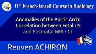 Anomalies of the Aortic Arch: Correlation between Fetal US and Postnatal MRI/CT - Reuven ACHIRON