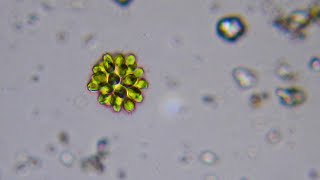 Golden Algae Colony Synura - Freshwater Microorganisms Explained