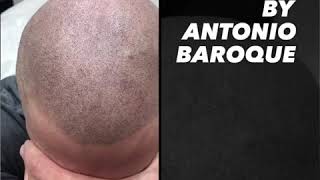 Scalp Micropigmentation by Antonio Baroque